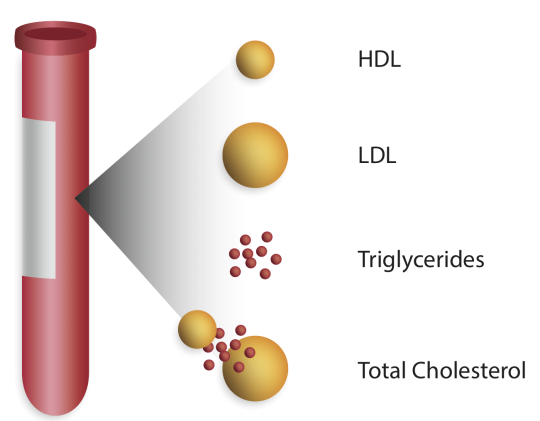 analizat e koleterolit